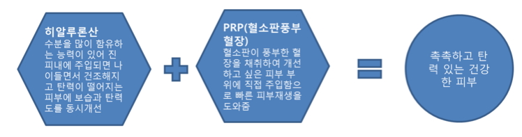 하일루론산+PRP.jpg