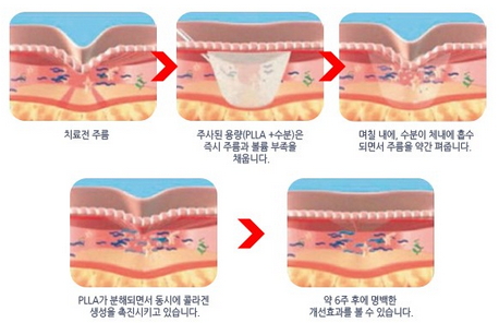 스컬트라_작용.jpg