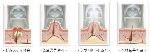 테라클리어 작동순서.jpg