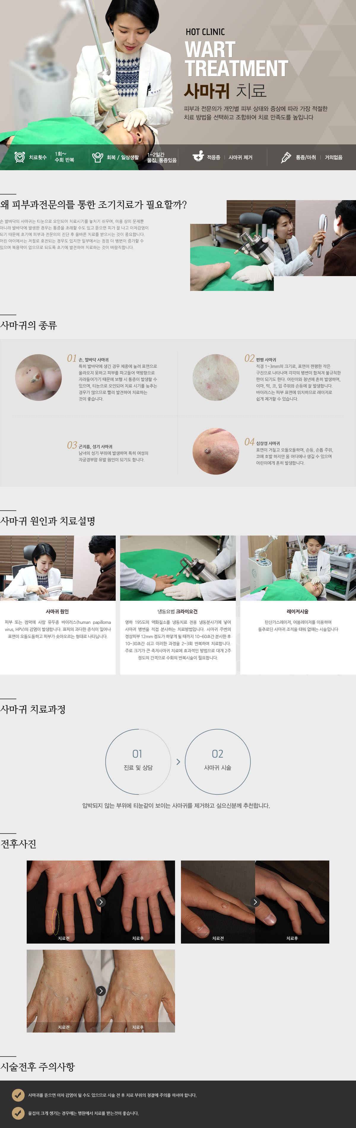 WART TREATMENT 사마귀 치료